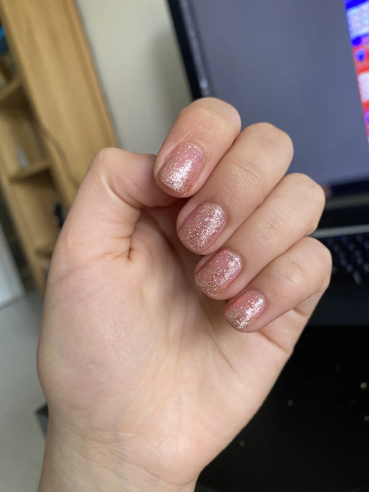 Lucky Uñas( Pozuelo de Alarcón—Avenida de europa )