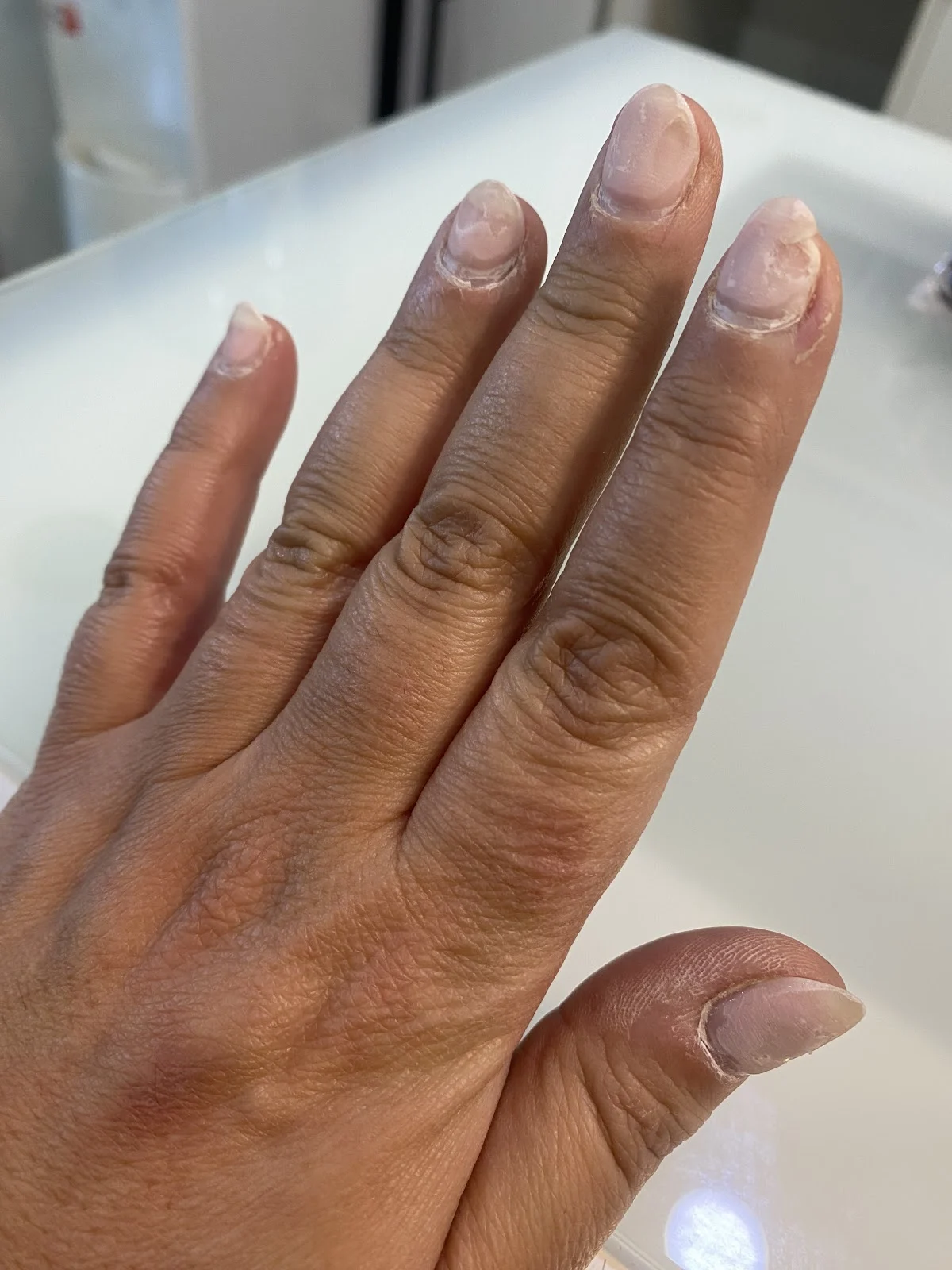 Nieves Uñas